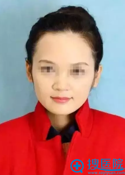 ������<!--<i data=20240710 data-id=11757></i>-->����ҽԺ��������¡��+¡�°�Ч����ô��