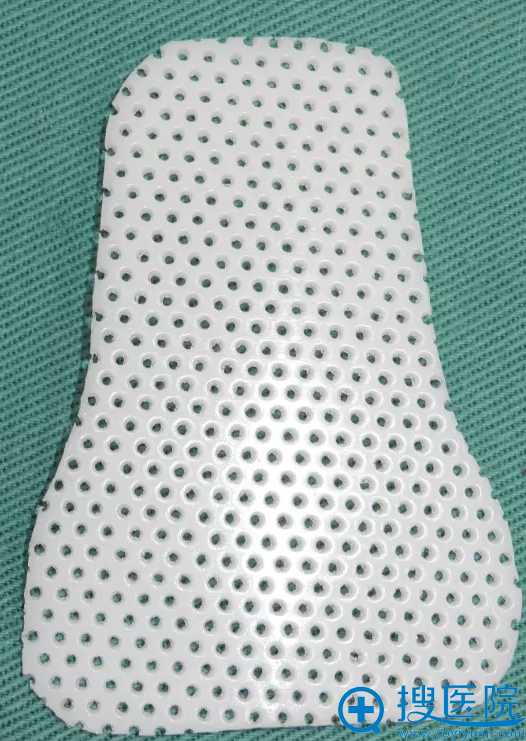 术后固定用的鼻套 术后固定用的鼻套