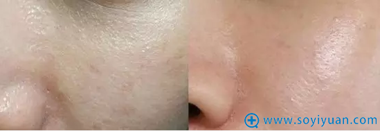 �ƽ�΢����Ͱ����Ա�