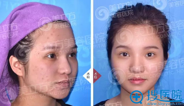 ���������߲��ഺ���ӡ�������۷�����
