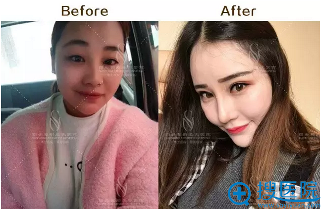 ��������һ����ǰ����Ա��մ̼����¶�����