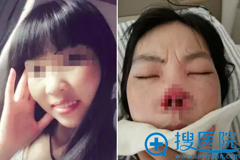 ����Ӣ��Ƥ������������Ŀ�봫ͳ��������Щ���