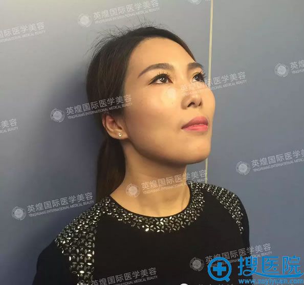 这是我的术前照 这是我的术前照