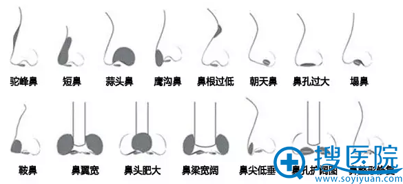可报名参加活动的鼻子类型 可报名参加活动的鼻子类型