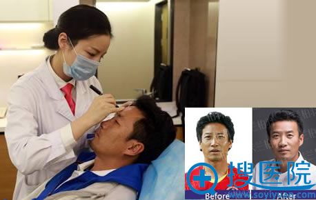 肖明明操作面部年轻化手术 肖明明操作面部年轻化手术