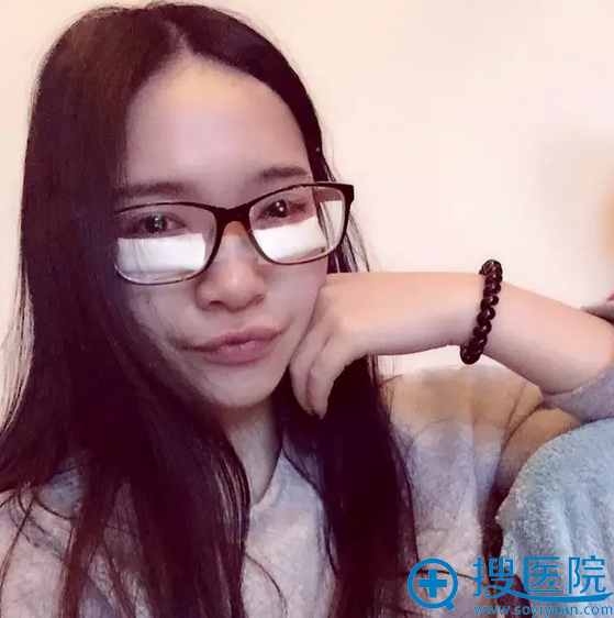 祛眼袋术后第1天,医生说10都不能戴隐形眼镜了 祛眼袋术后第1天,医生说10都不能戴隐形眼镜了