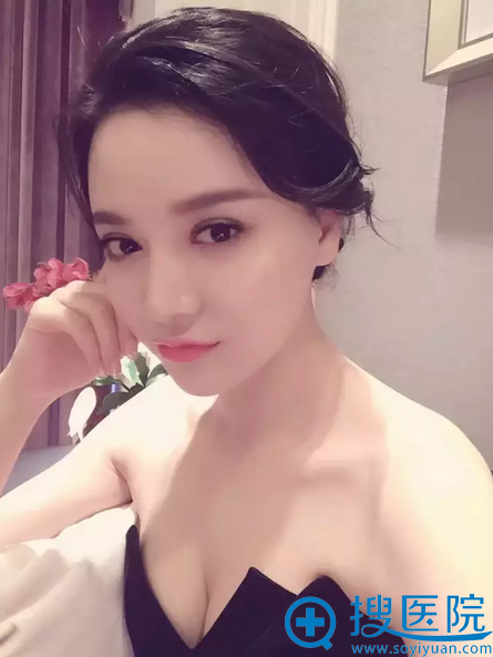华美索康立秀膨体隆鼻案例 华美索康立秀膨体隆鼻案例