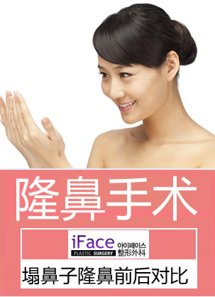 【真实经历】看我在韩国iFace做的塌鼻子隆鼻前后对比照片