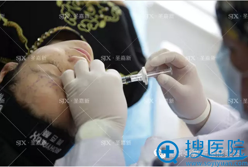 医生开始为我注射润百颜玻尿酸中 医生开始为我注射润百颜玻尿酸中