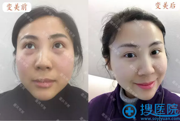 ���컪�������޺����۴�ǰ��Ա���