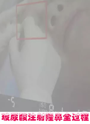��ֱ������ɳ�Ǻ����ζ�����Ժ��������ע��¡�ǶԱ���Ƭ