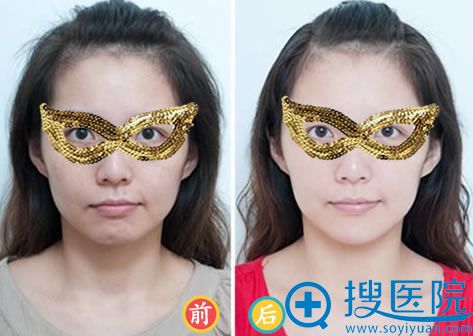 ���ڸ��������沿�ߵ�Ч���Ա���Ƭ
