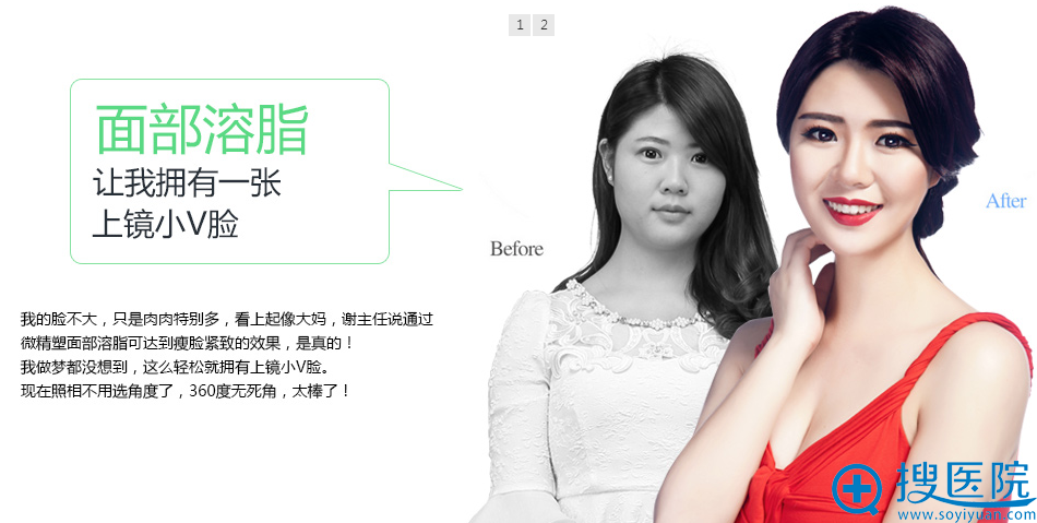 重庆当代整形谢锦清面部溶脂前后对比照片 重庆当代整形谢锦清面部溶脂前后对比照片