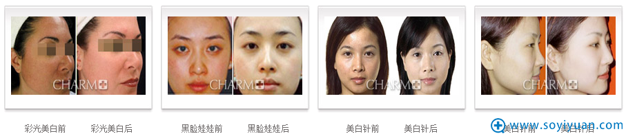 重庆当代面部美白案例 重庆当代面部美白案例