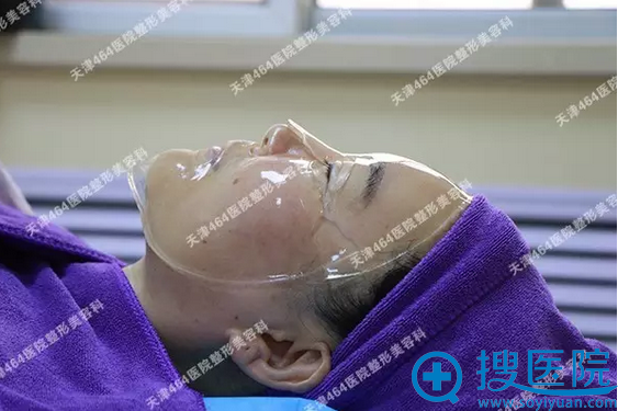 热拉提治疗后,面部有些红 热拉提治疗后,面部有些红