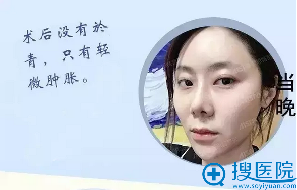 面部线雕天效果 面部线雕天效果