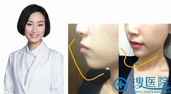 厦门华美注射医生张晓英及成功案例 厦门华美注射医生张晓英及成功案例