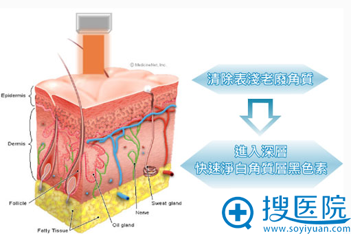 黑脸娃娃和白瓷娃娃有什么区别以及两项手术案例效果对比