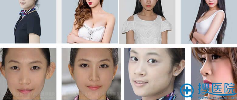 厦门华美整形美容案例效果图 厦门华美整形美容案例效果图
