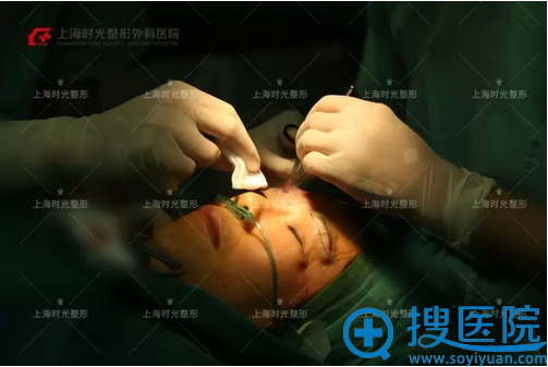 许黎平提眉术手术照片 许黎平提眉术手术照片