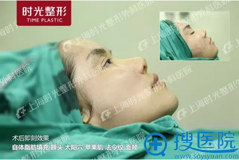 琳娜手术后即刻对比图 琳娜手术后即刻对比图