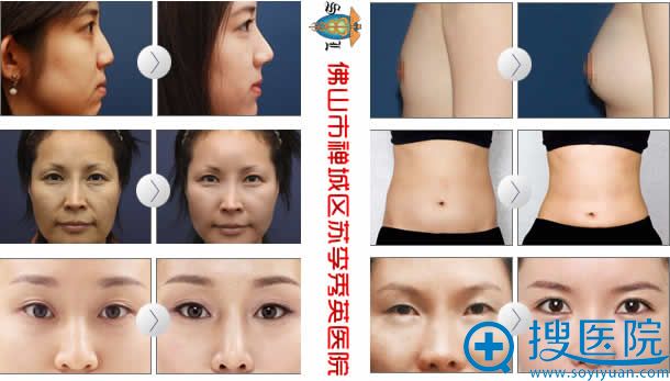 <!--<i data=20240710 data-id=8127></i>-->整形医院案例图 <!--<i data=20240710 data-id=8127></i>-->整形医院案例图
