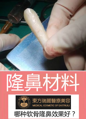 肋软骨、耳软骨和鼻中隔软骨如何选择?鼻整形王军给你指路