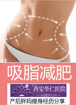 【真实经历】看产后胖妈在西安华仁整形韩式吸脂减肥对比照片