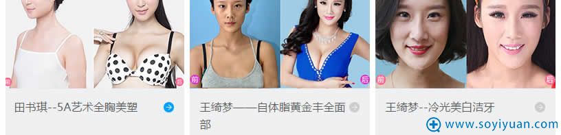 佛山曙光金子医学美容医院案例效果图 佛山曙光金子医学美容医院案例效果图