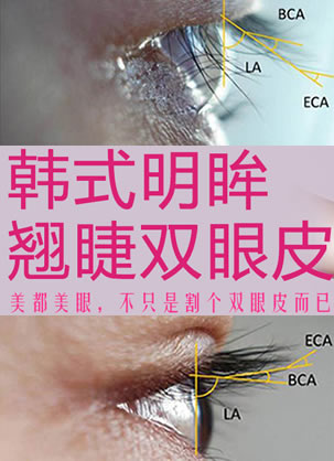 在武汉美都做双眼皮怎么样?张浩院长韩式翘睫明眸双眼皮效果图