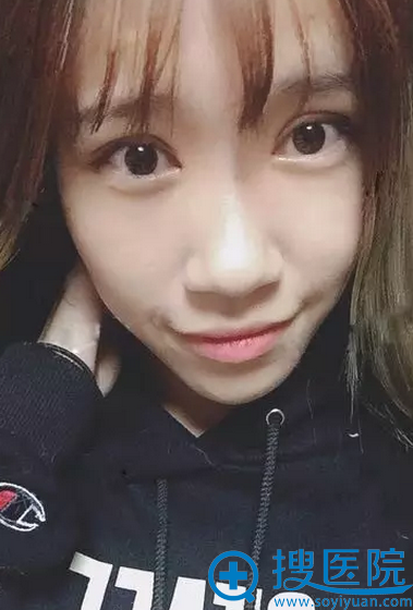 ˫��Ƥ����40�죬��Ҷ�˵����ű�����