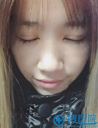 ˫��Ƥ�����10�����Ч��