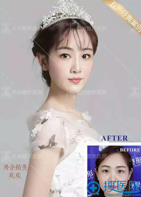 <!--<i data=20240710 data-id=15866></i>-->医生真人案例 <!--<i data=20240710 data-id=15866></i>-->医生真人案例