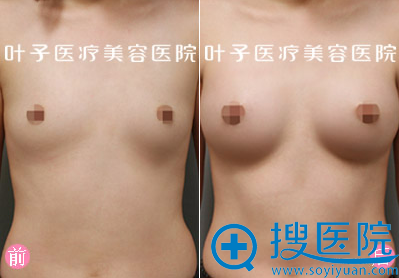 �人Ҷ������֬�����ذ���
