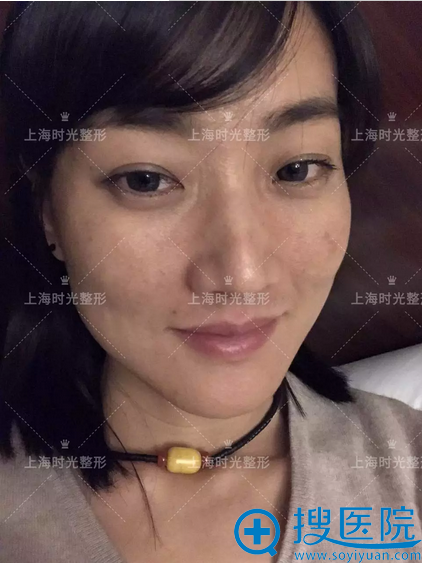 ����ʵ���������Ϻ�ʱ����Ƥ�뼤�����һ�� ����ʵЧ����ô��