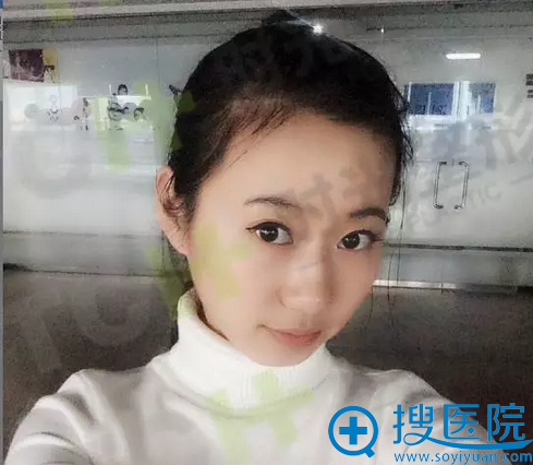 纹眉前照片 纹眉前照片