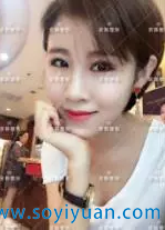 面雕+脂肪填充3个月效果 面雕+脂肪填充3个月效果
