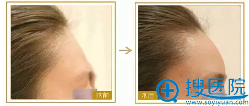 �人��������ҽԺ3��19������΢����ע�������Ƚ�������