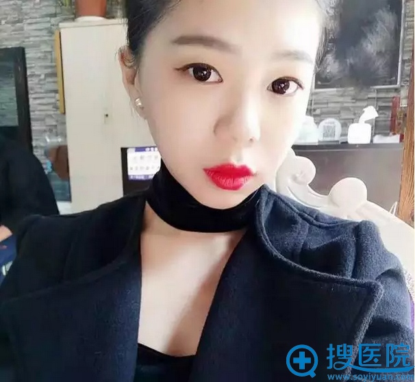 术后生活照 术后生活照