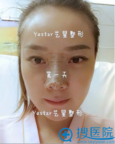 ���ۺ������켴��Ч��