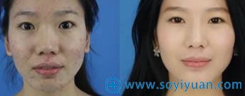 福州海峡美肤案例效果图 福州海峡美肤案例效果图