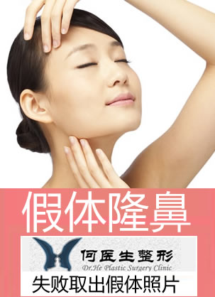 隆鼻失败取出假体照片 大连何医生鼻整形取出硅胶假体全过程