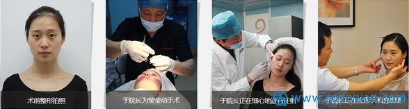 于院长为莹莹进行了双眼皮手术,注射丰苹果肌、 于院长为莹莹进行了双眼皮手术,注射丰苹果肌、