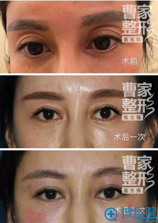 常德曹家6D无痕魅眼术真人案例 常德曹家6D无痕魅眼术真人案例