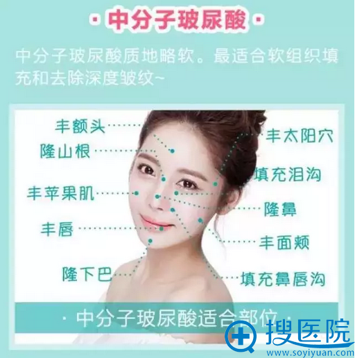 中分子玻尿酸的效果 中分子玻尿酸的效果
