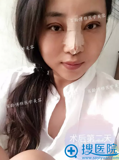 ˫��Ƥ�ڶ���ָ�����