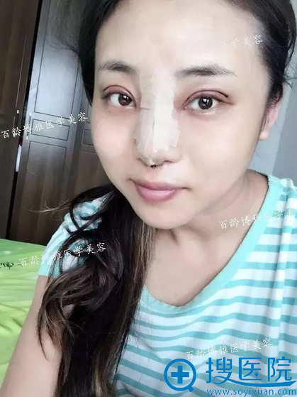 ˫��Ƥ������Ч��