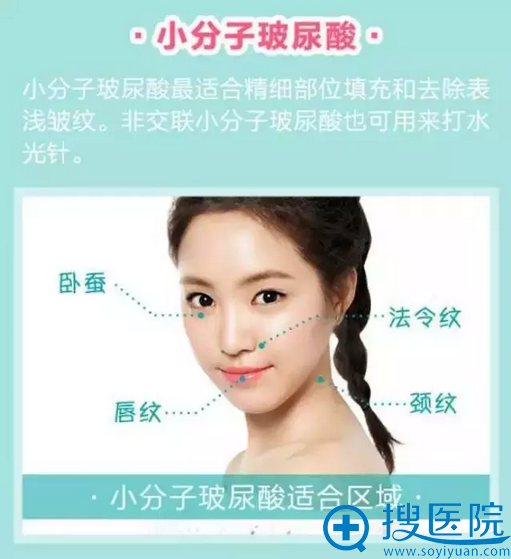 小分子玻尿酸的效果 小分子玻尿酸的效果