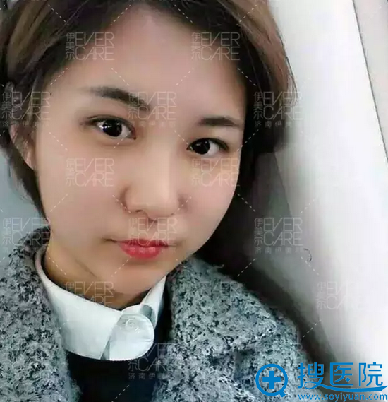 半个月了,恢复的很自然 半个月了,恢复的很自然