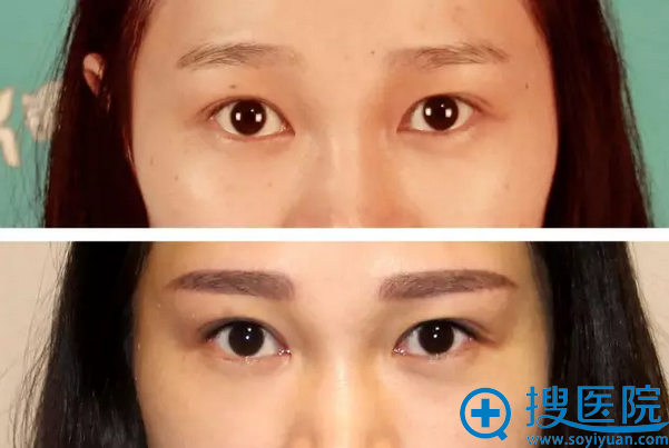 韩式半纹眉+美瞳线案例 韩式半纹眉+美瞳线案例